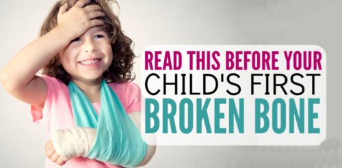 What to do when your kid breaks his arm or leg? This post is a lifesaver and I am so glad I found this parenting advice! I had no idea I may not need to take my child to an emergency room. Great parenting tips